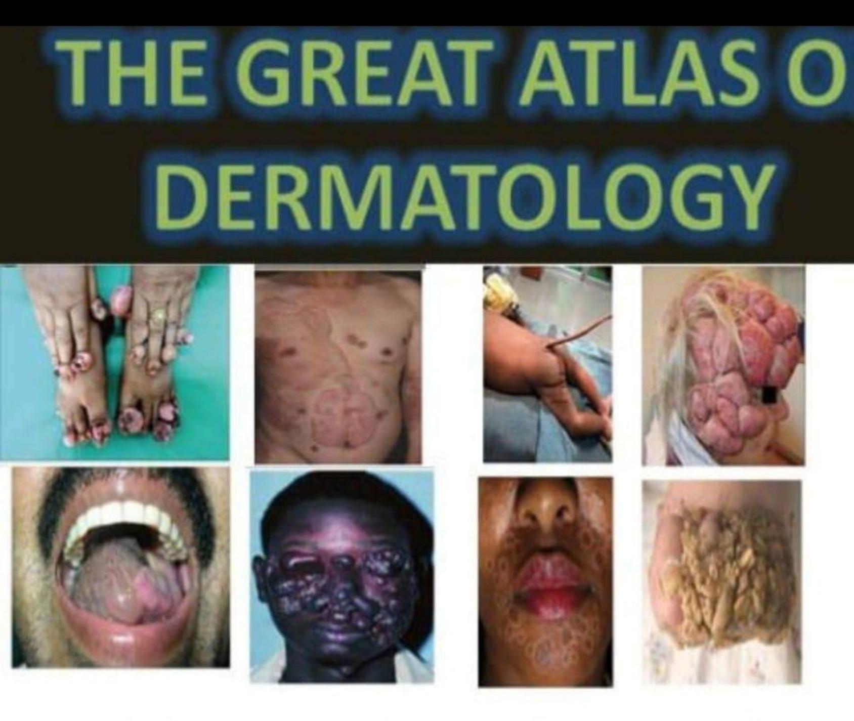 E3 great atlas of dermatology indexed 2023 by hany salah soliman