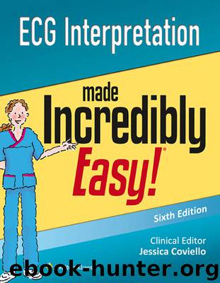 ECG Interpretation Made Incredibly Easy! (Incredibly Easy! Series®) by Lippincott Williams && Wilkins