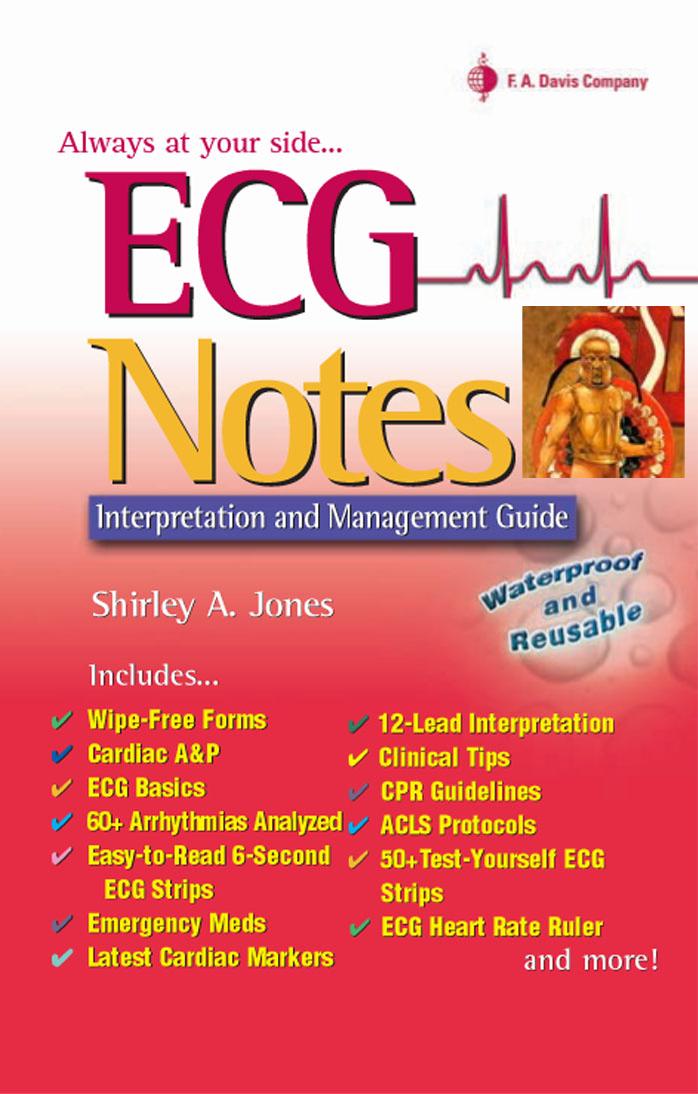 ECG Notes Interpretation And Management Guide by Unknown