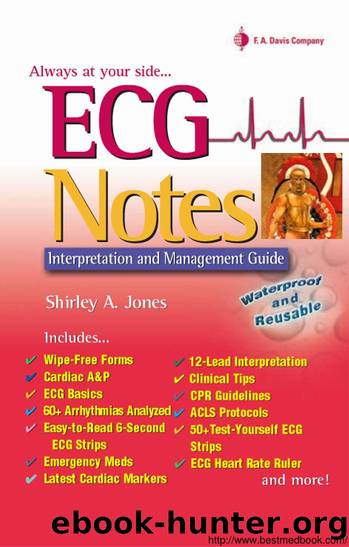 ECG Notes Interpretation and Management Guide (Shirley A. Jones) by Unknown