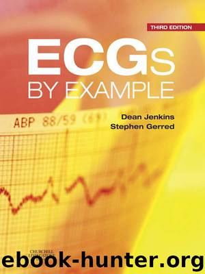 ECGs by Example