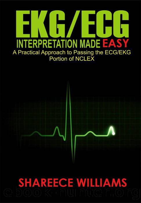 EKGECG Interpretation Made Easy: A Practical Approach to Passing the ECGEKG Portion of NCLEX by Shareece Williams