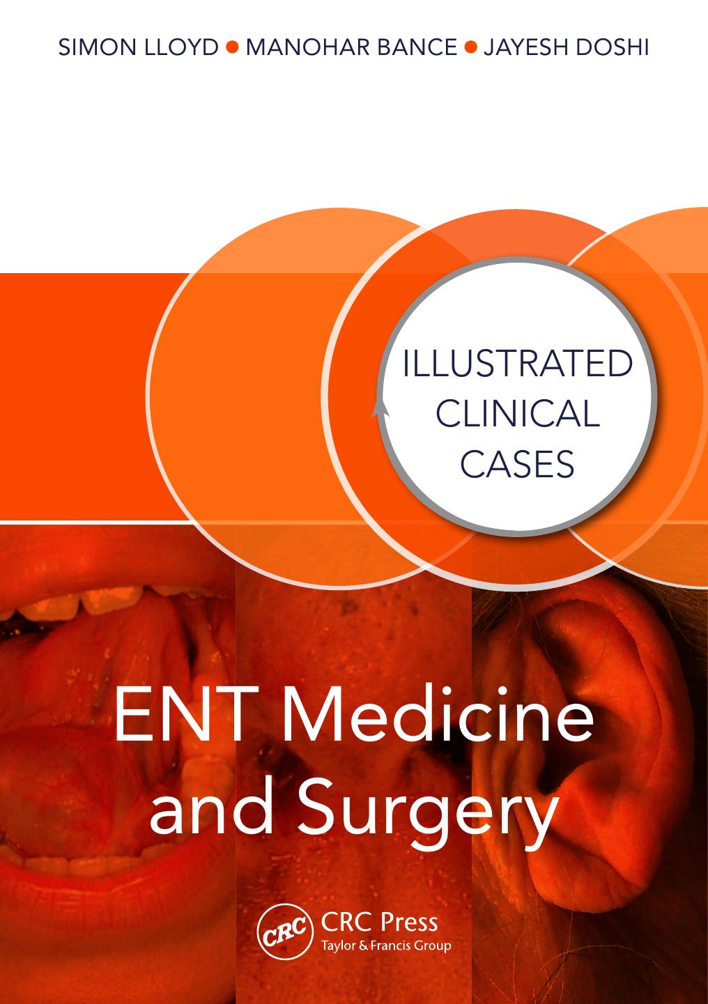 ENT Medicine and Surgery: Illustrated Clinical Cases by Simon Kinglsey Wickham Lloyd Manohar Bance Jayesh Doshi
