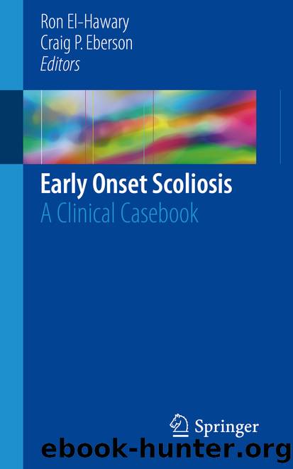 Early Onset Scoliosis by Ron El-Hawary & Craig P. Eberson