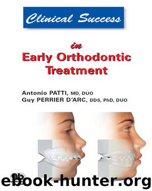 Early Orthodontic Treatment by Antonio Patti