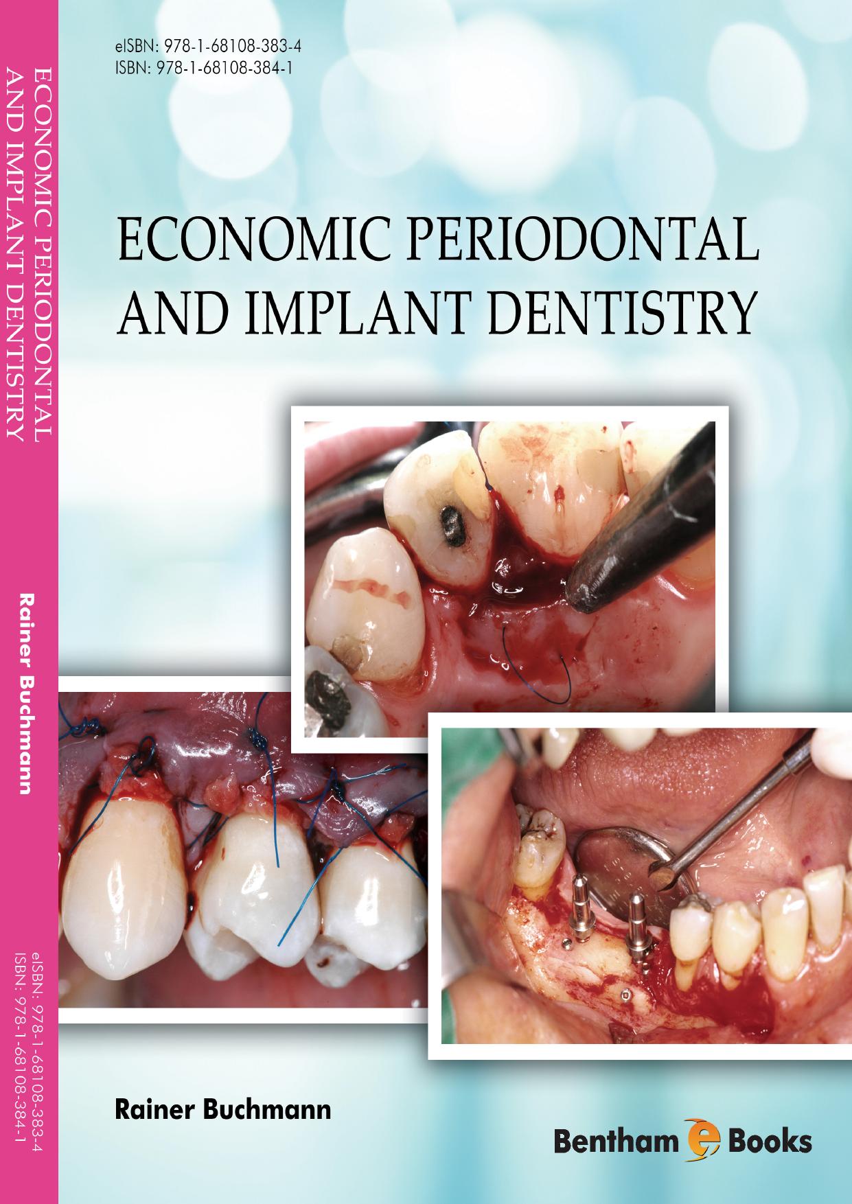 Economic Periodontal and Implant Dentistry by Rainer Buchmann