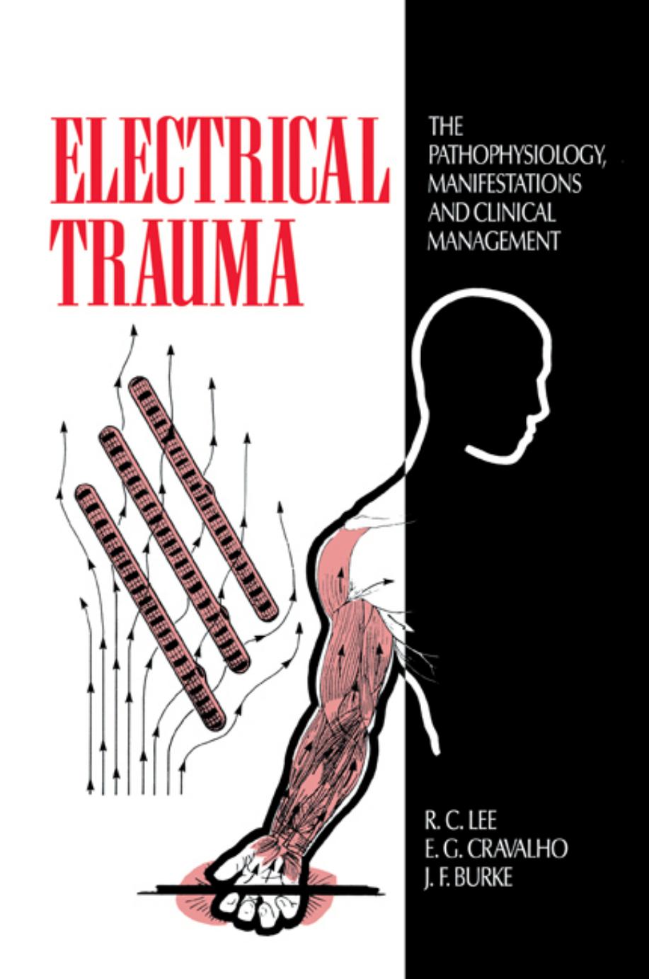 Electrical Trauma: The Pathophysiology, Manifestations and Clinical Management by R. C. Lee E. G. Cravalho J. F. Burke