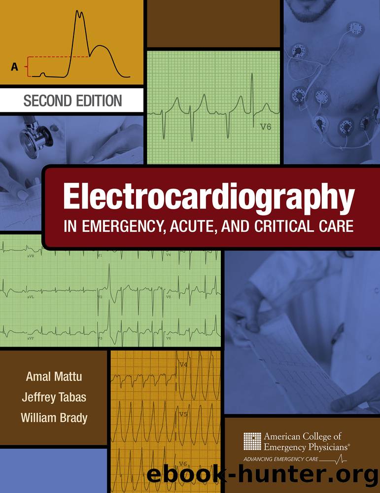 Electrocardiography in Emergency, Acute, and Critical Care by Amal Mattu