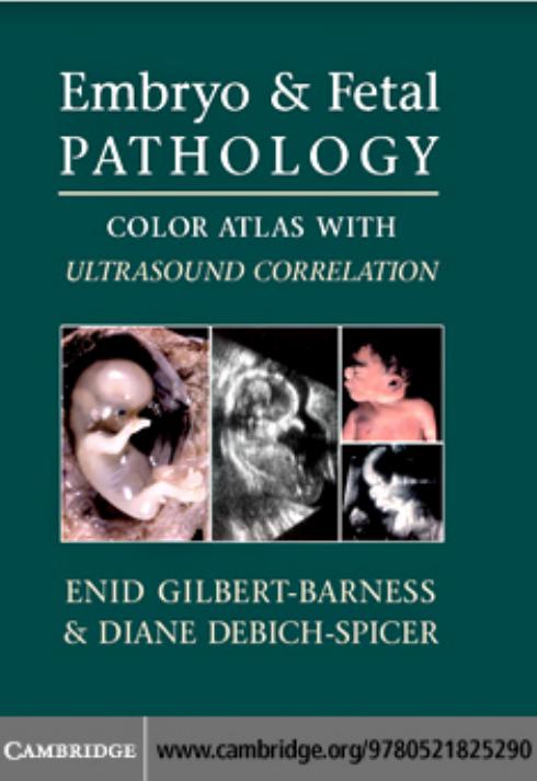 Embryo and Fetal Pathology: Color Atlas with Ultrasound Correlation by Enid Gilbert-Barness