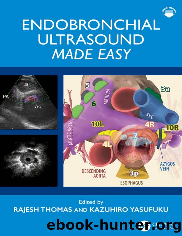 Endobronchial Ultrasound Made Easy by Thomas Rajesh;Yasufuku Kazuhiro; & Kazuhiro Yasufuku