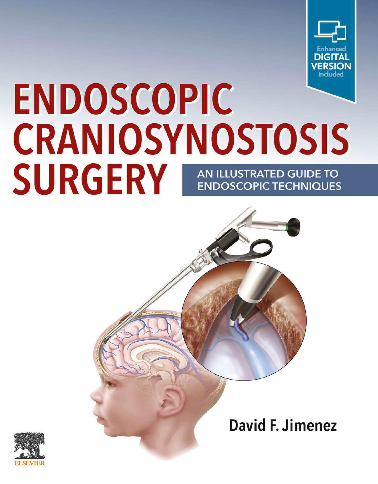 Endoscopic Craniosynostosis Surgery: An Illustrated Guide to Endoscopic Techniques by David F. Jimenez (editor)