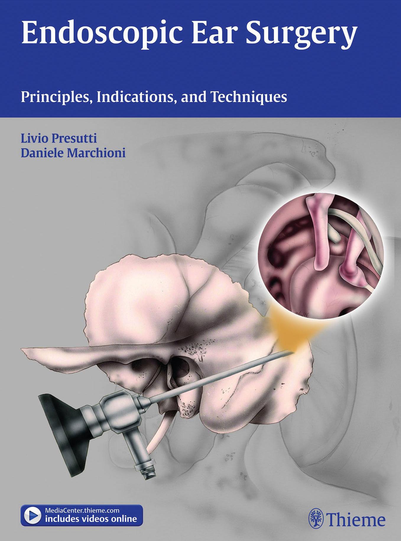 Endoscopic Ear Surgery: Principles, Indications, and Techniques by Livio Presutti Daniele Marchioni