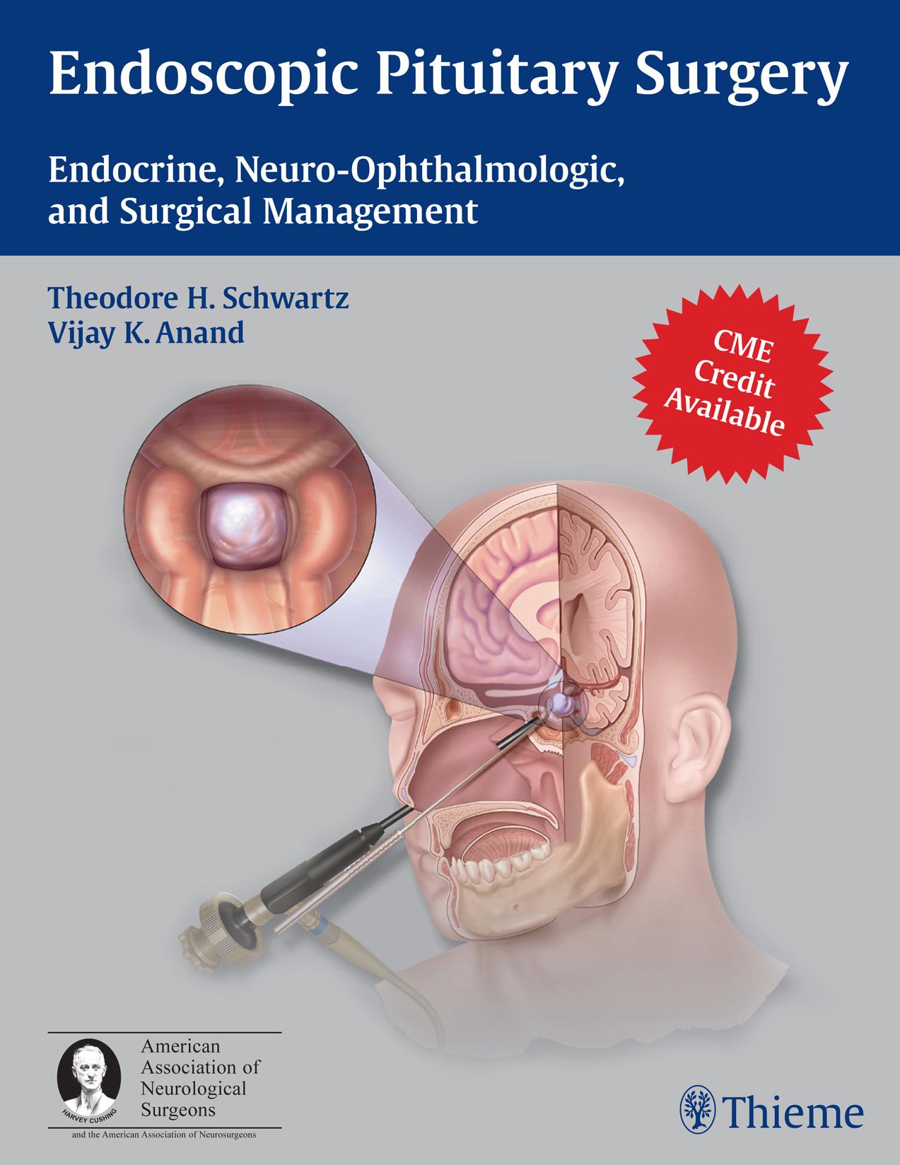 Endoscopic Pituitary Surgery: Endocrine, Neuro-Ophthalmologic, and Surgical Management by Theodore H. Schwartz Vijay K. Anand