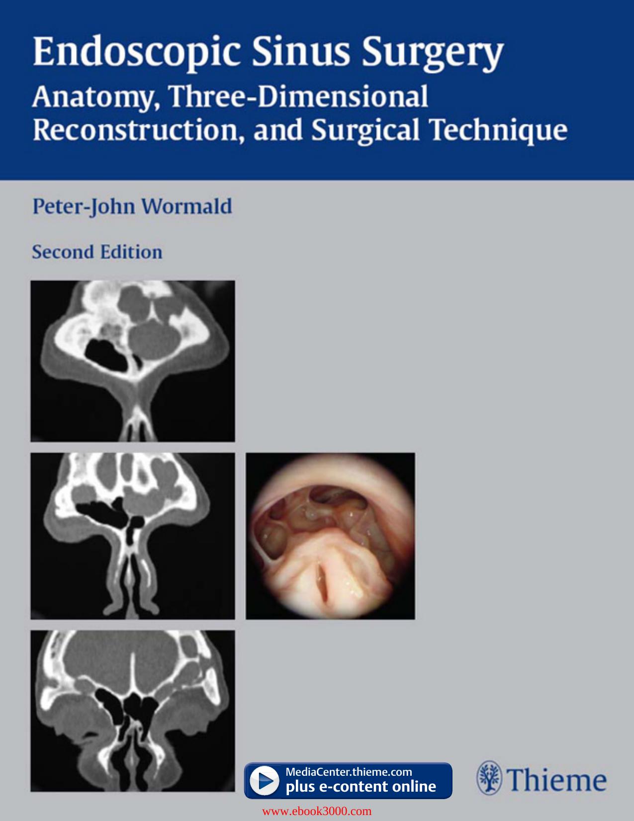 Endoscopic Sinus Surgery: Anatomy, Three-Dimensional Reconstruction, and Surgical Technique, 2 edition by Unknow