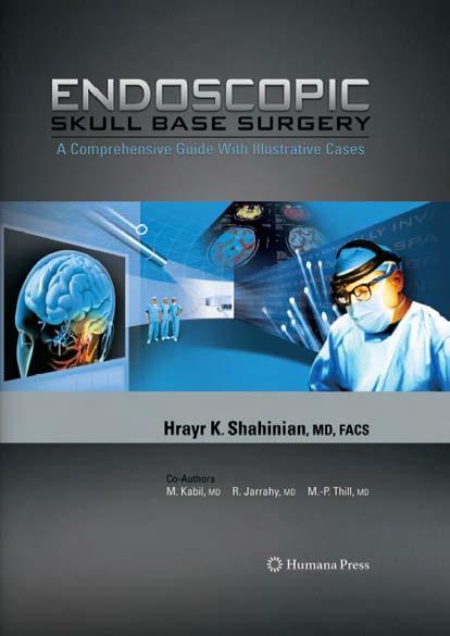 Endoscopic Skull Base Surgery by A Comprehensive Guide & Illustrative Cases