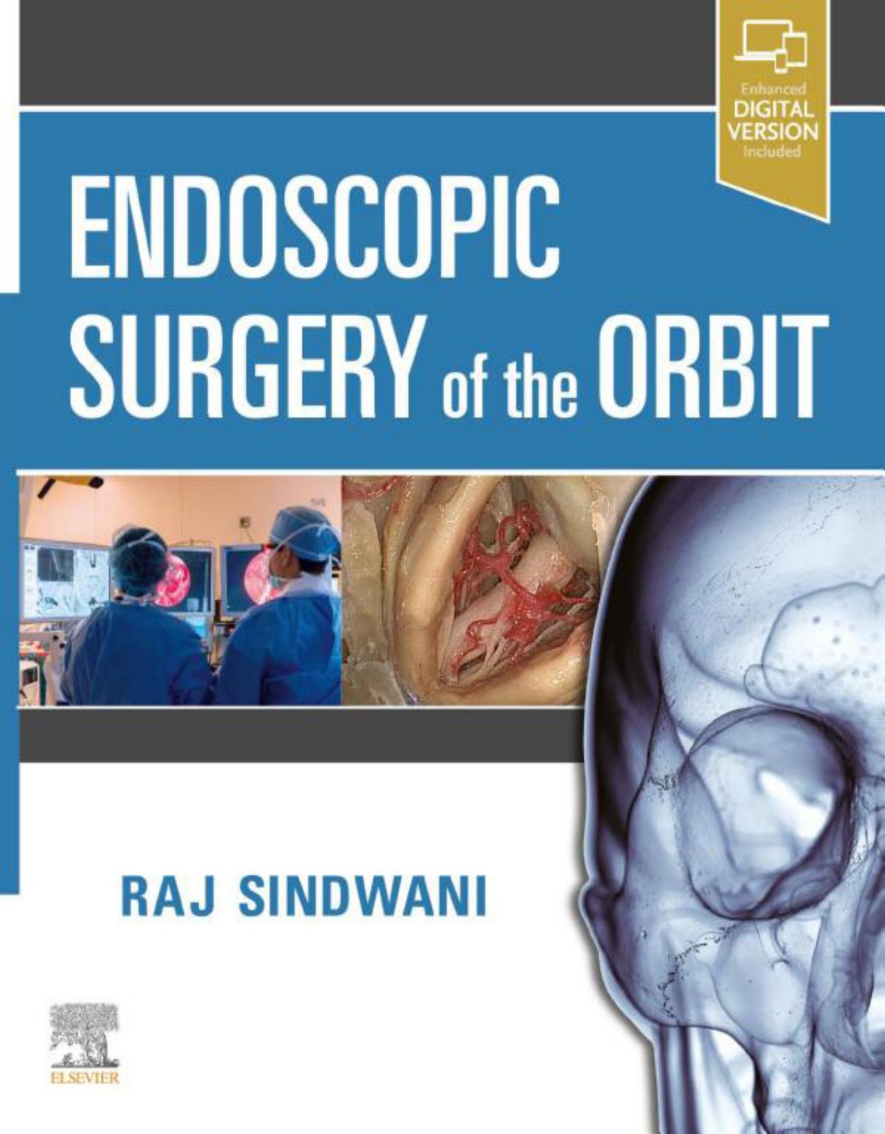 Endoscopic Surgery of the Orbit by Raj Sindwani