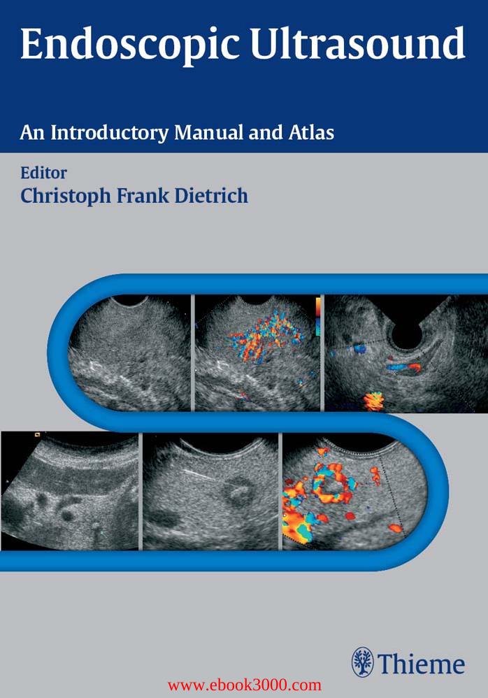 Endoscopic Ultrasound: An Introductory Manual and Atlas by Unknow