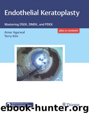 Endothelial Keratoplasty by Amar Agarwal Terry Kim