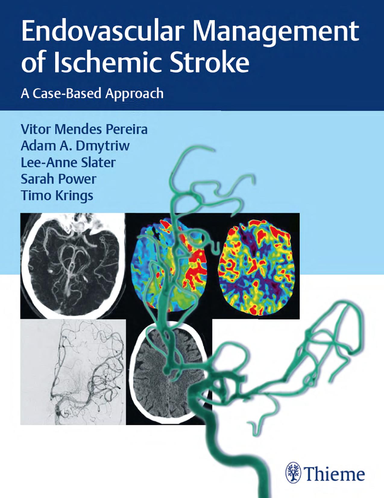 Endovascular Management of Ischemic Stroke: A Case-based Approach by Vitor Mendes Pereira; Adam A. Dmytriw; Lee-Anne Slater; Sarah Power; Timo Krings
