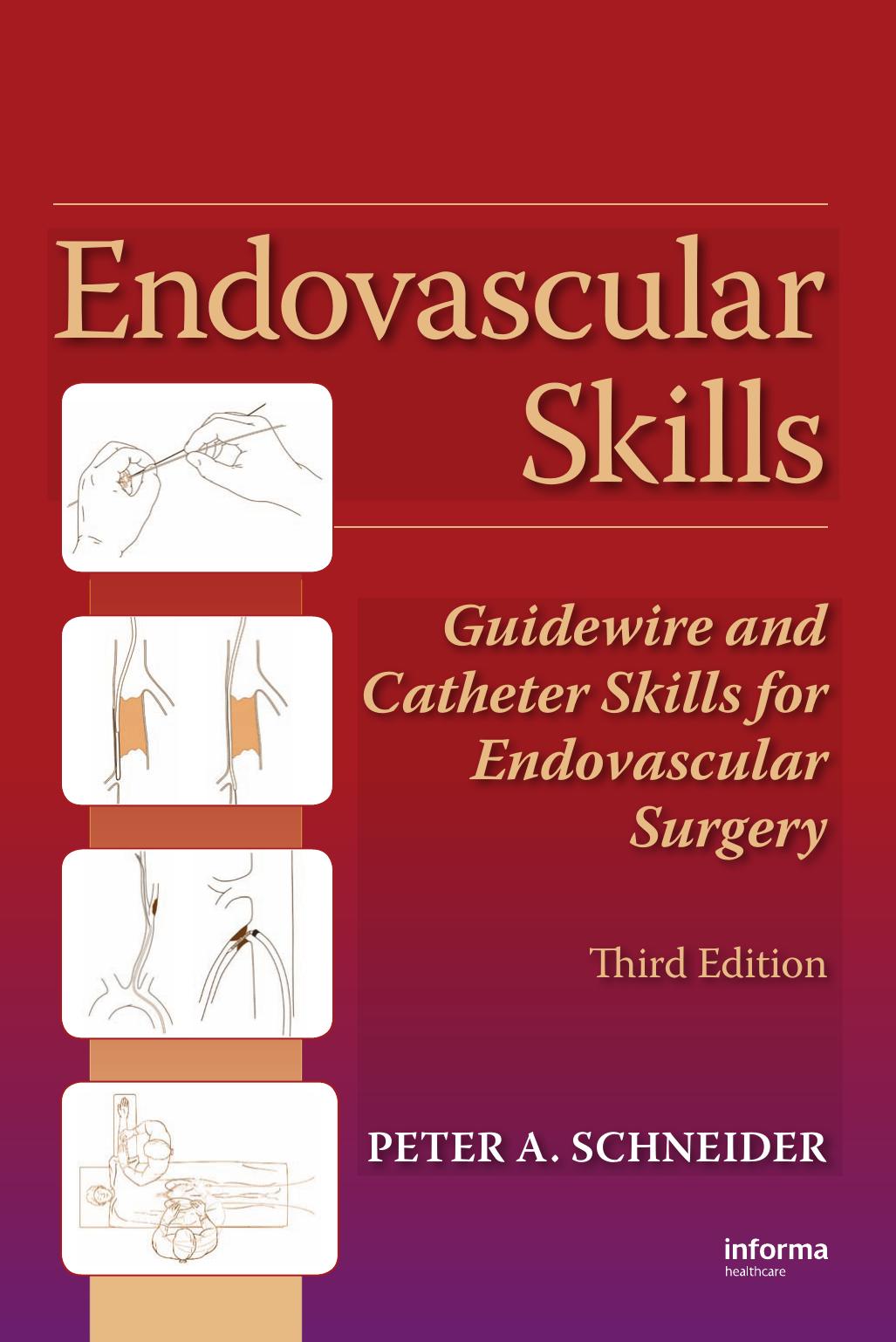 Endovascular Skills: Guidewire and Catheter Skills for Endovascular Surgery by A. Schneider Peter