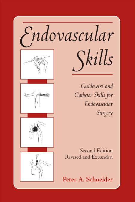 Endovascular Skills: Guidewire and Catheter Skills for Endovascular Surgery, Second Edition, by Peter Schneider