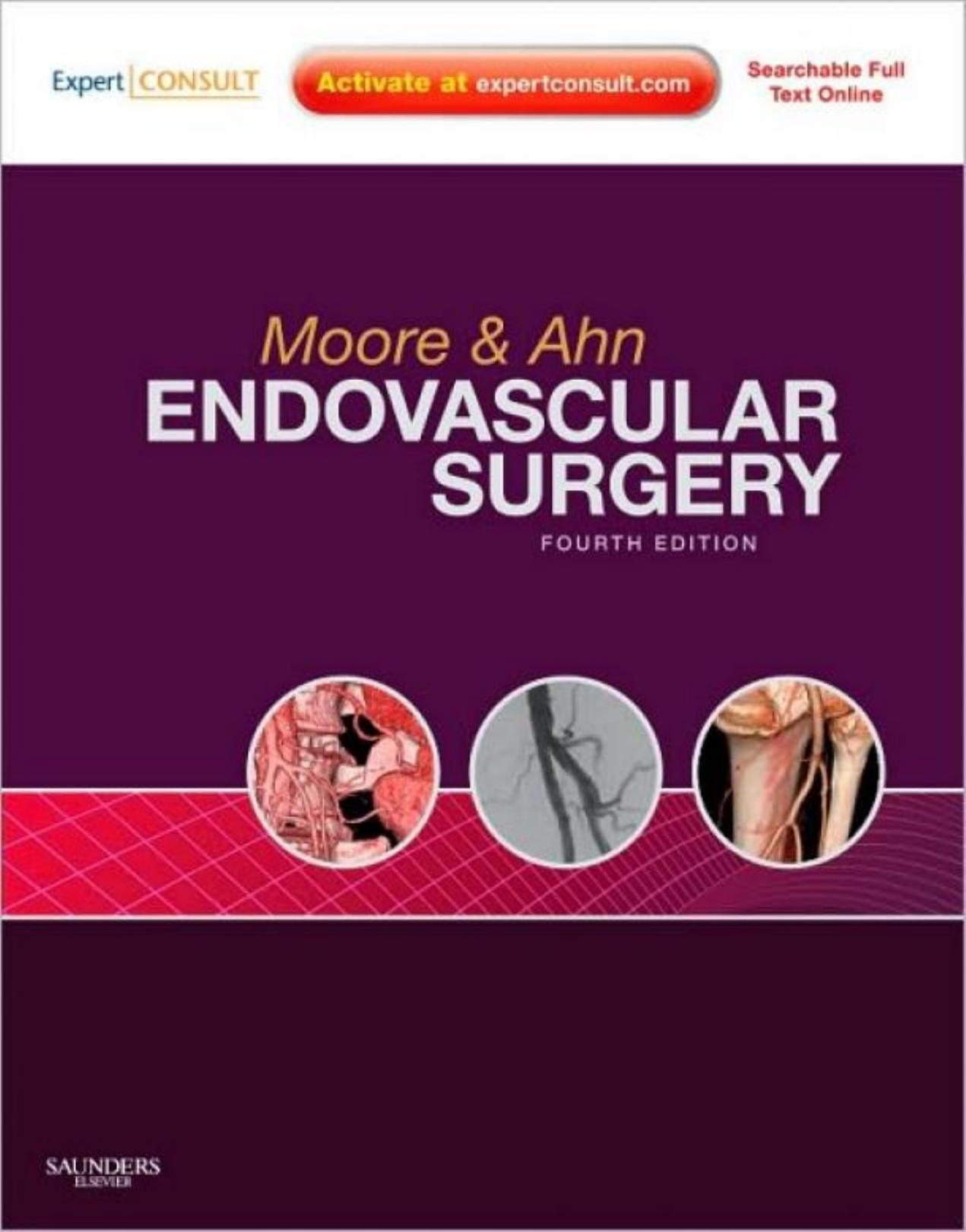 Endovascular Surgery: Expert Consult by Wesley S. Moore MD (Author)