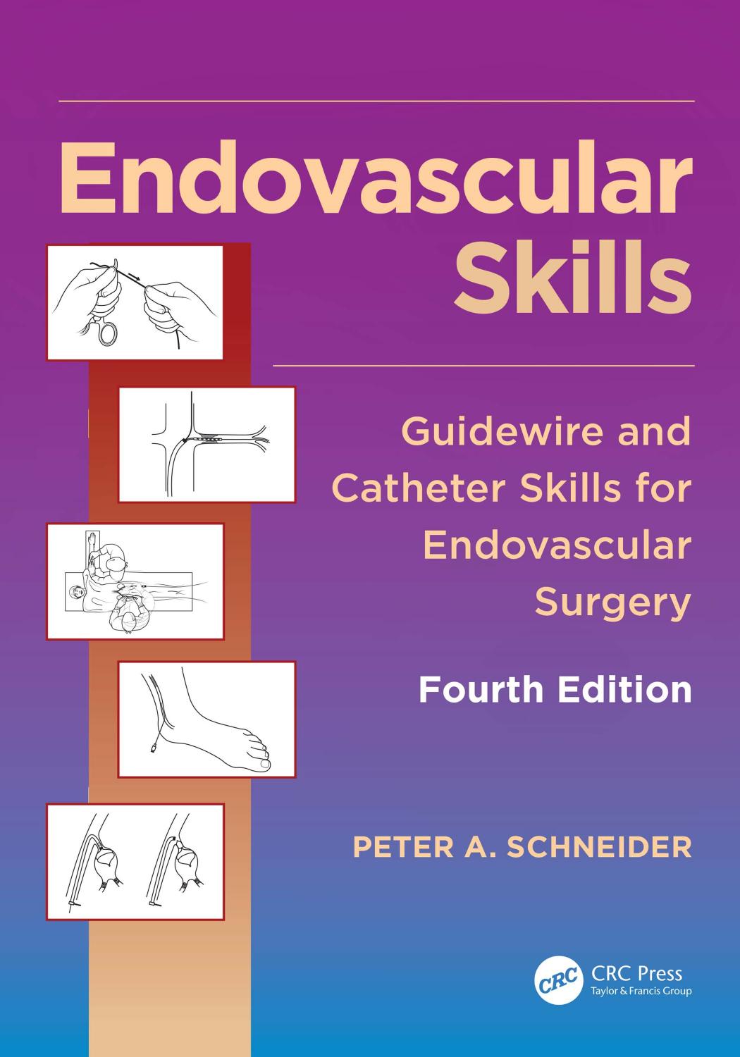 Endovascular skills : guidewire and catheter skills for endovascular surgery by Peter A. Schneider