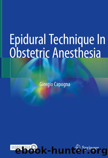 Epidural Technique In Obstetric Anesthesia by Giorgio Capogna
