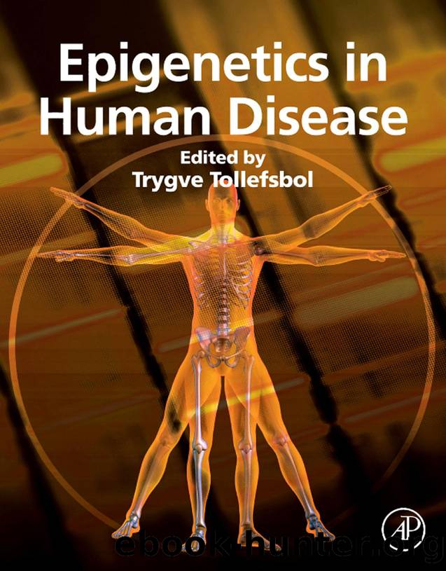 Epigenetics in Human Disease by Unknown