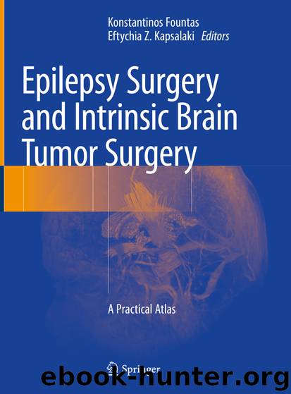 Epilepsy Surgery and Intrinsic Brain Tumor Surgery by Unknown