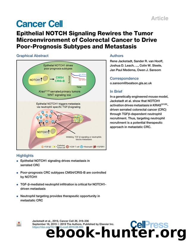 Epithelial NOTCH Signaling Rewires the Tumor Microenvironment of Colorectal Cancer to Drive Poor-Prognosis Subtypes and Metastasis by unknow