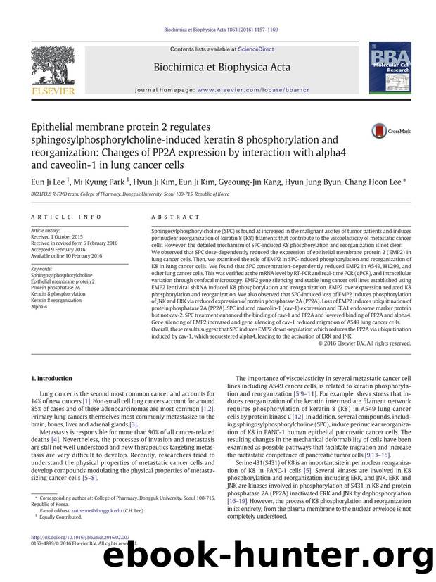 Epithelial membrane protein 2 regulates sphingosylphosphorylcholine-induced keratin 8 phosphorylation and reorganization: Changes of PP2A expression by interaction with alpha4 and  by unknow