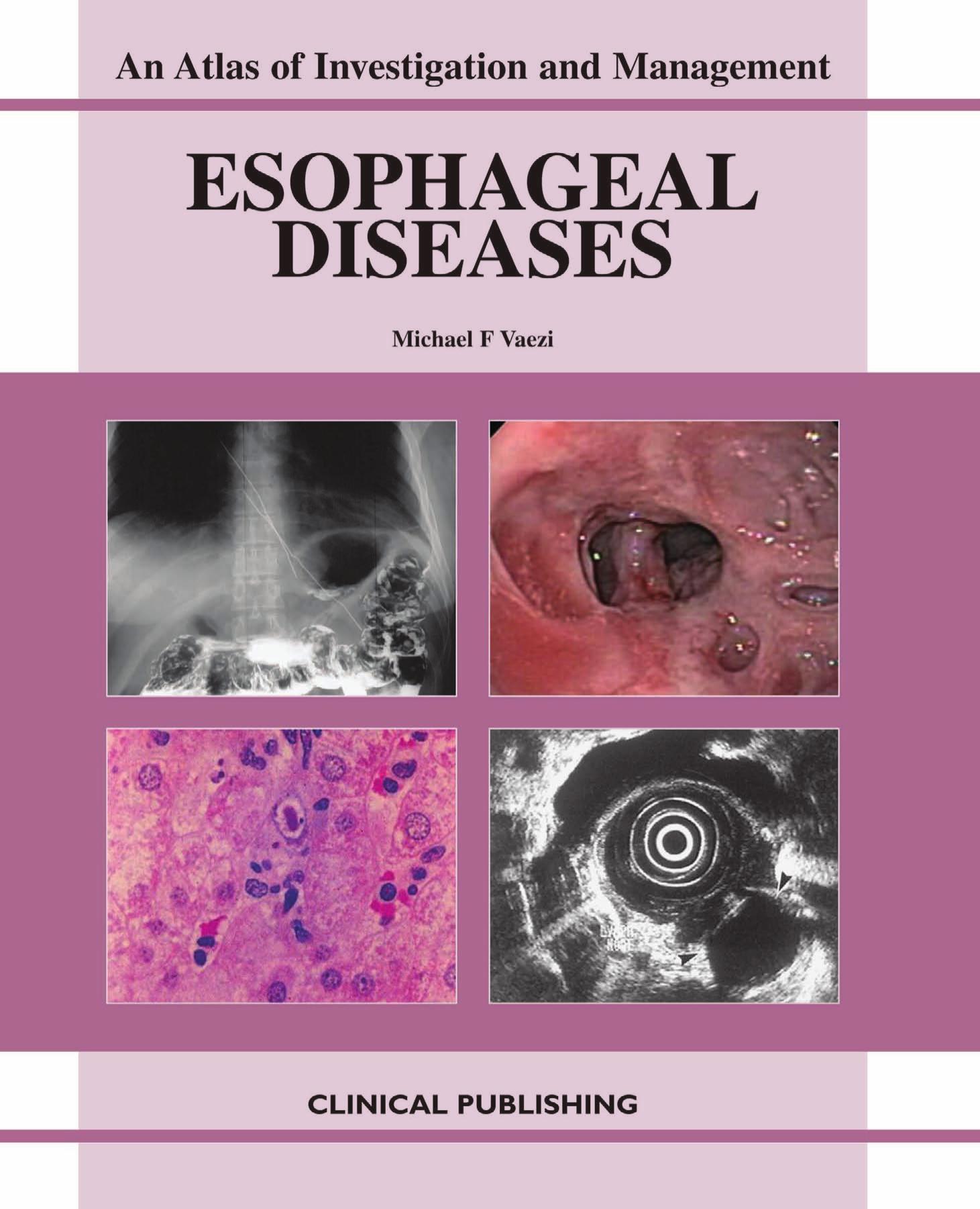 Esophageal Diseases: An Atlas of Investigation and Management by Michael F. Vaezi