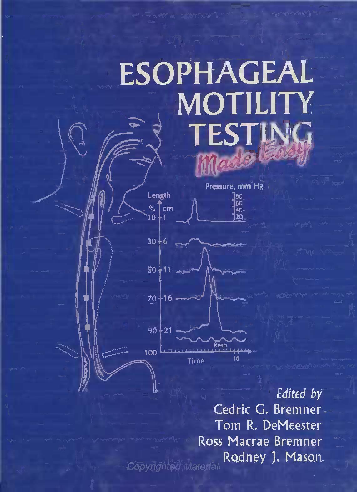 Esophageal motility testing made easy by C G Bremner