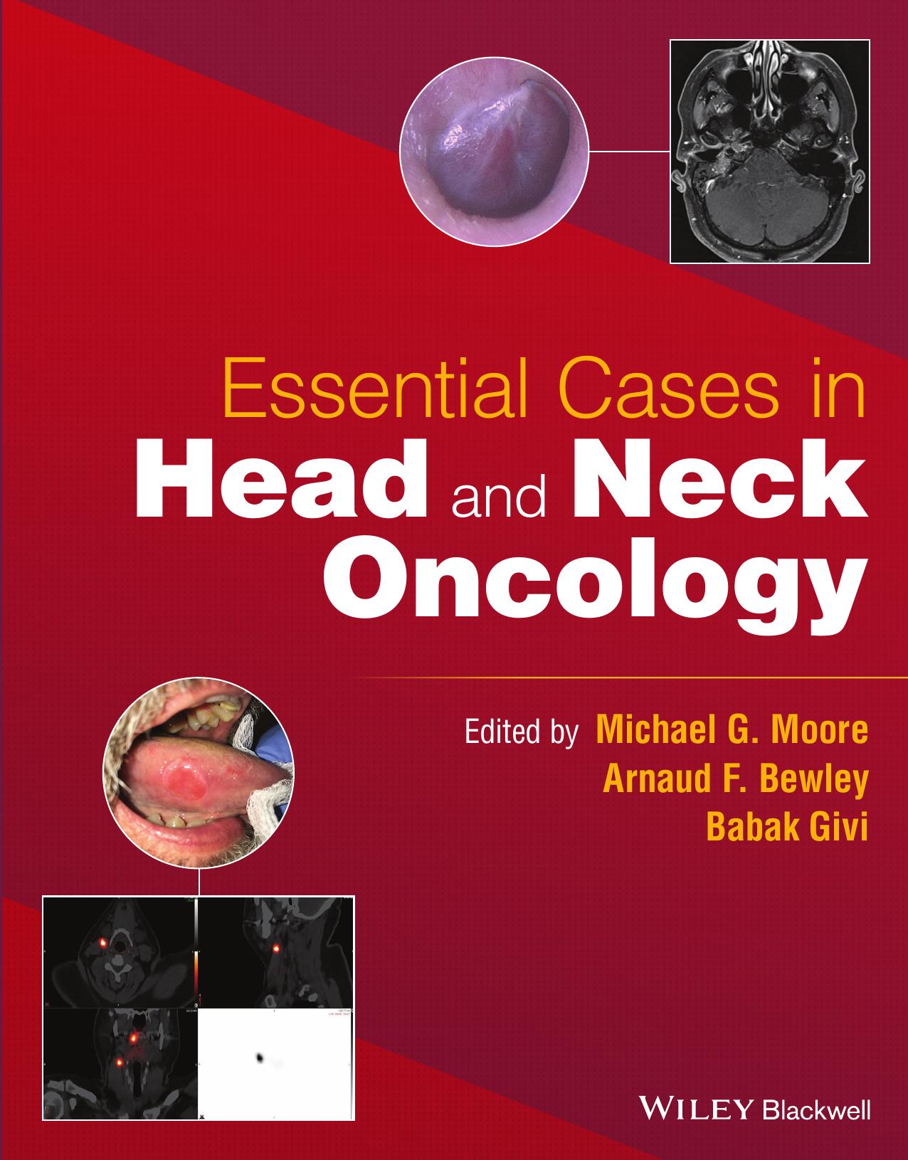 Essential Cases in Head and Neck Oncology by Michael G. Moore Arnaud F. Bewley Babak Givi (eds.)