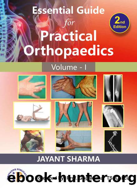 Essential Guide for Practical Orthopaedics Volume - I by Sharma Jayant