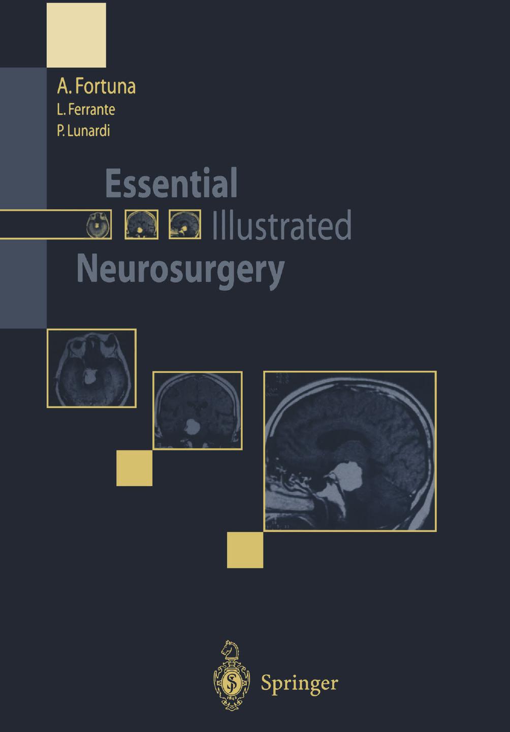 Essential Illustrated Neurosurgery by Aldo Fortuna M.D. Luigi Ferrante M.D. Pierpaolo Lunardi (auth.)
