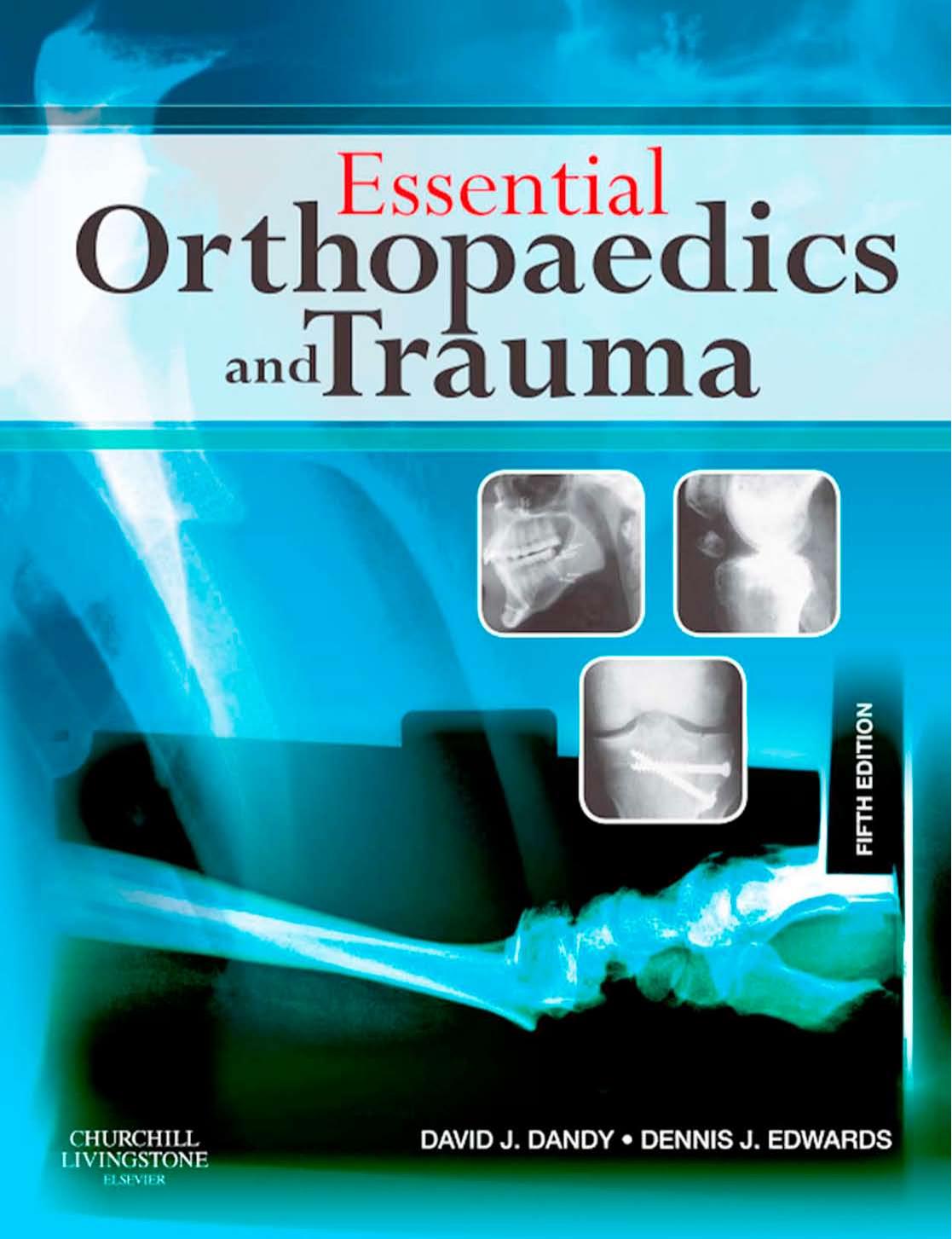 Essential Orthopaedics and Trauma by David Dandy Dennis Edwards