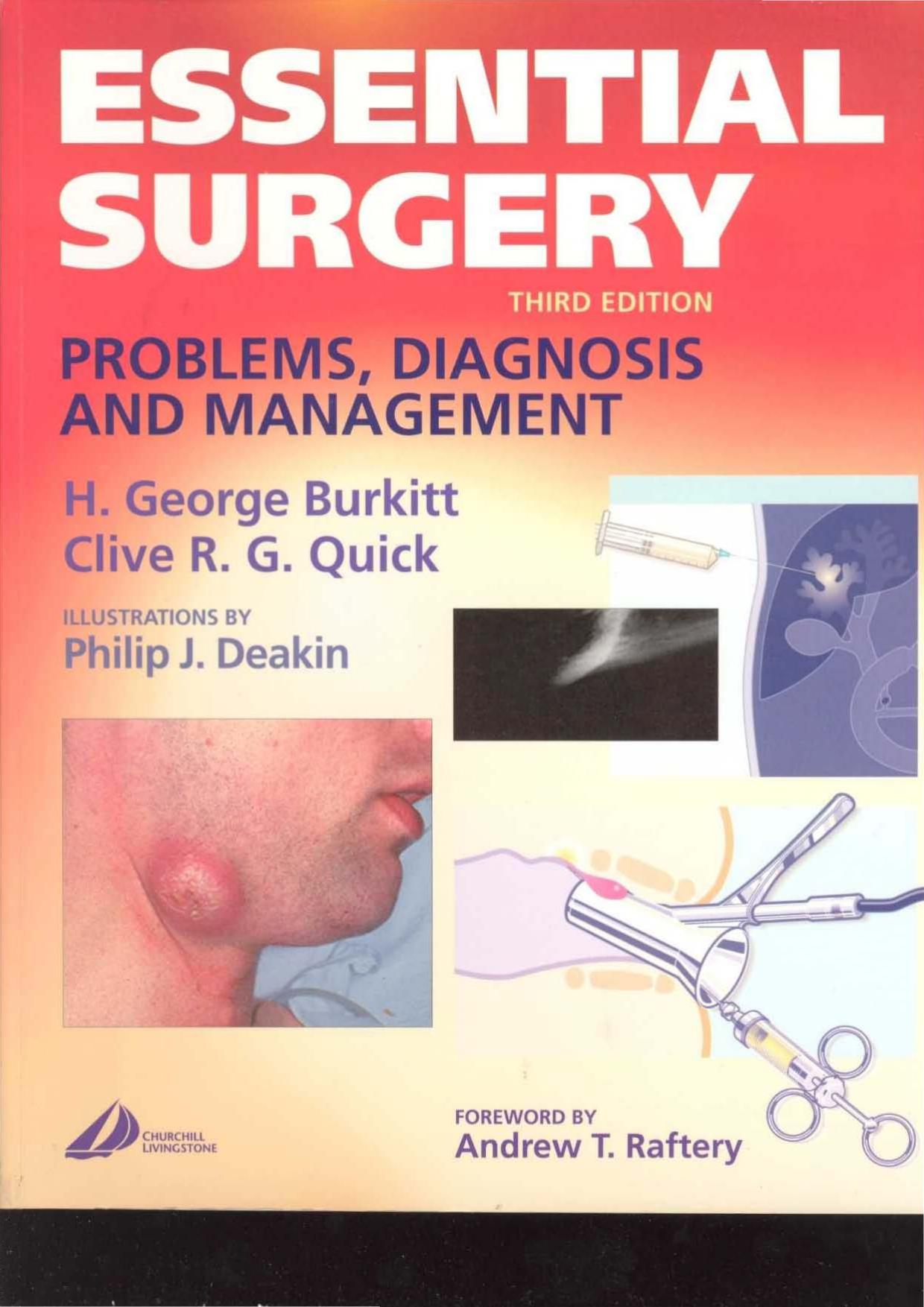 Essential Surgery: Problems, Diagnosis and Management, Third Edition by H. George Burkitt