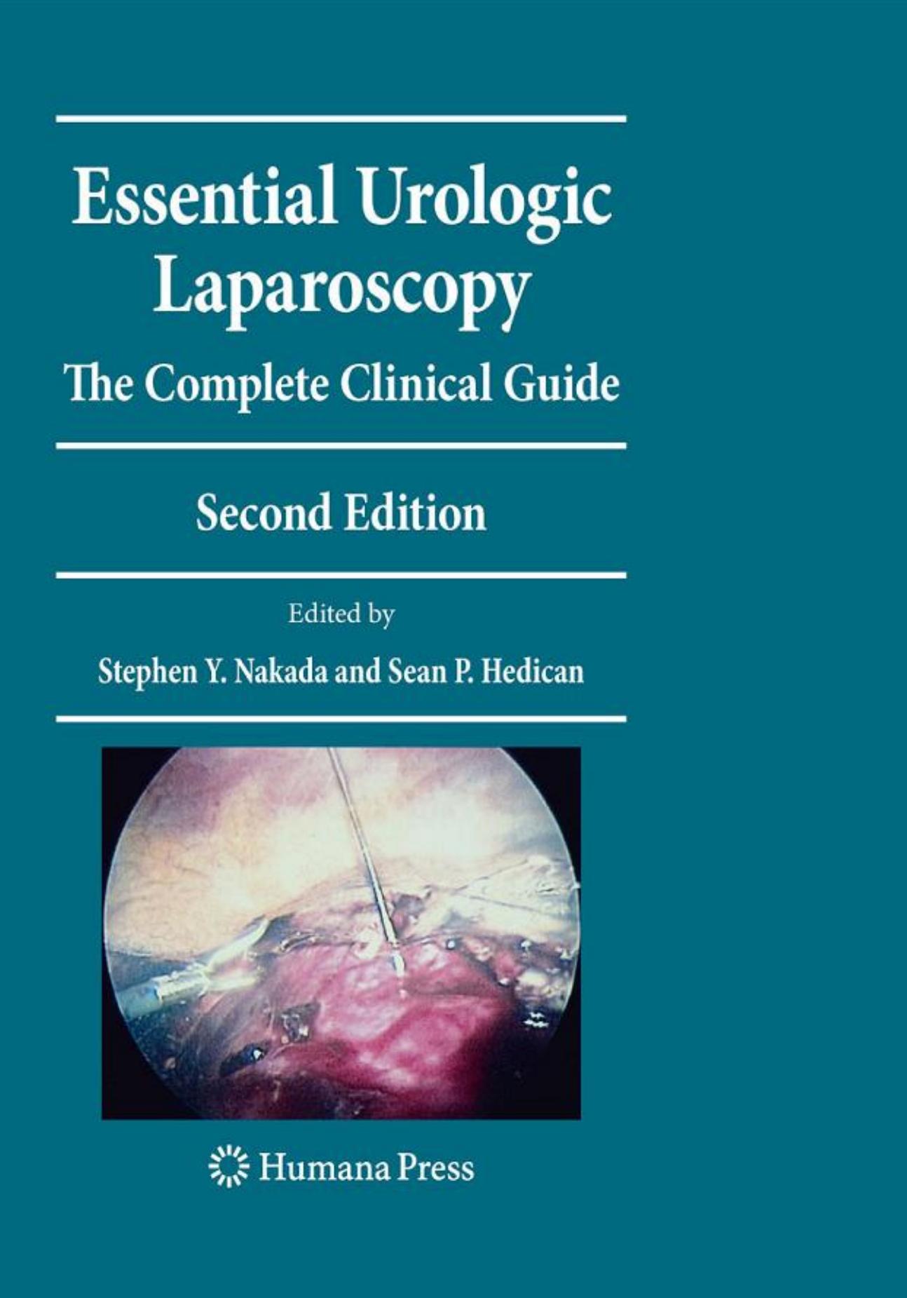 Essential Urologic Laparoscopy: The Complete Clinical Guide by Unknow