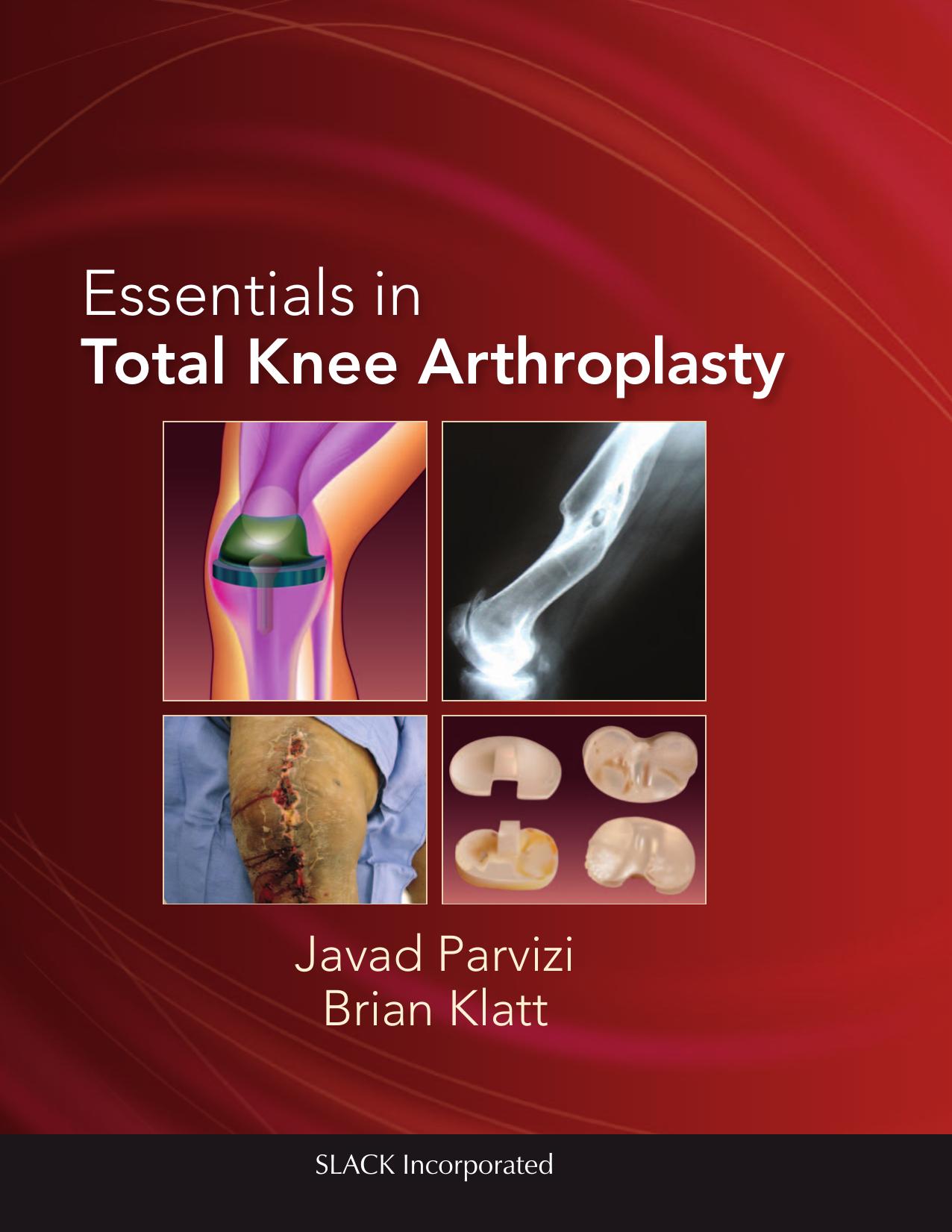 Essentials in Total Knee Arthroplasty by Javad Parvizi; Brian Klatt