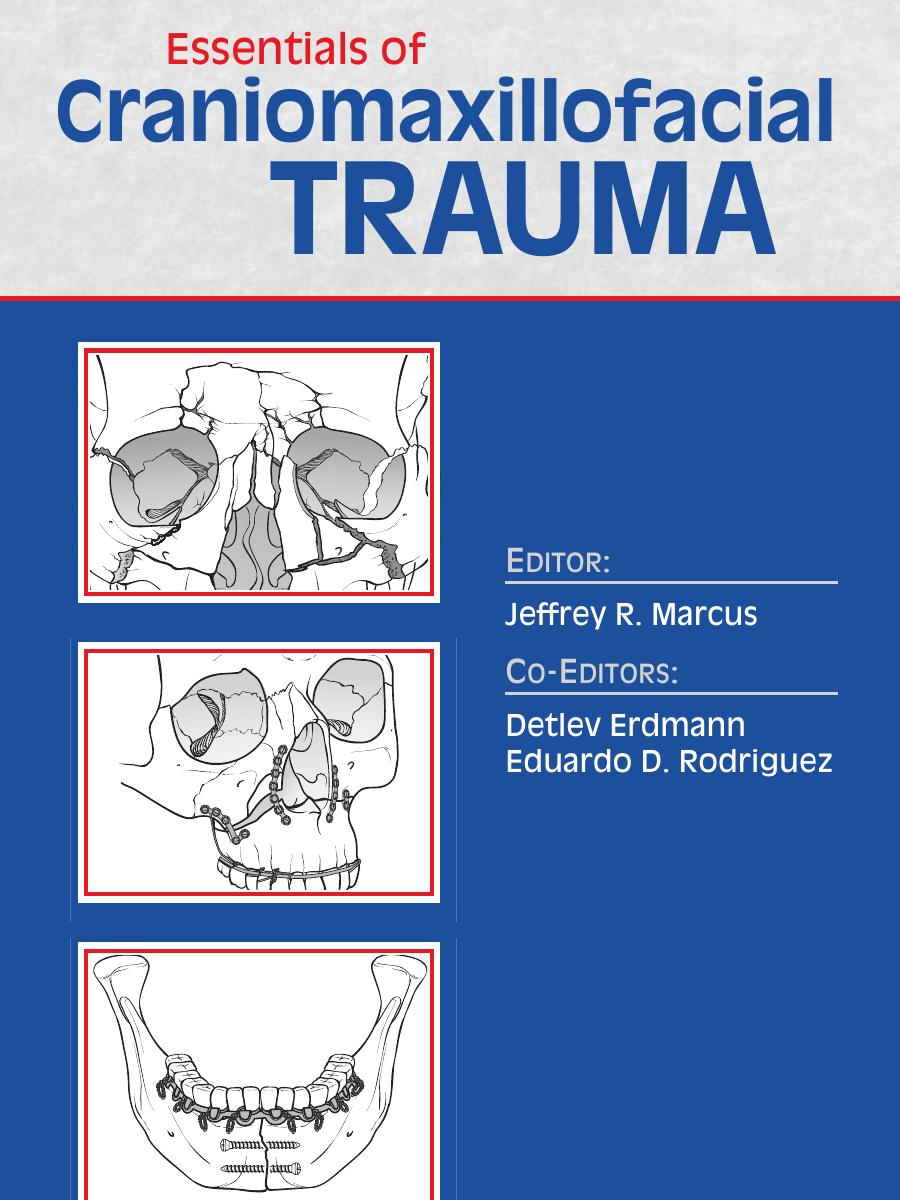 Essentials of Craniomaxillofacial Trauma by Erdmann MD Detlev; Marcus MD Jeffrey R.; Rodriguez MD Eduardo D