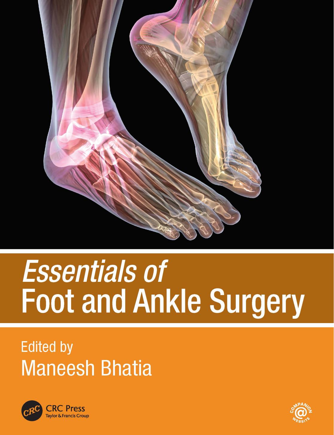 Essentials of Foot and Ankle Surgery by Maneesh Bhatia & MS (Orth) & PG Dip (Tr && Orth) and FRCS (Tr && Orth)