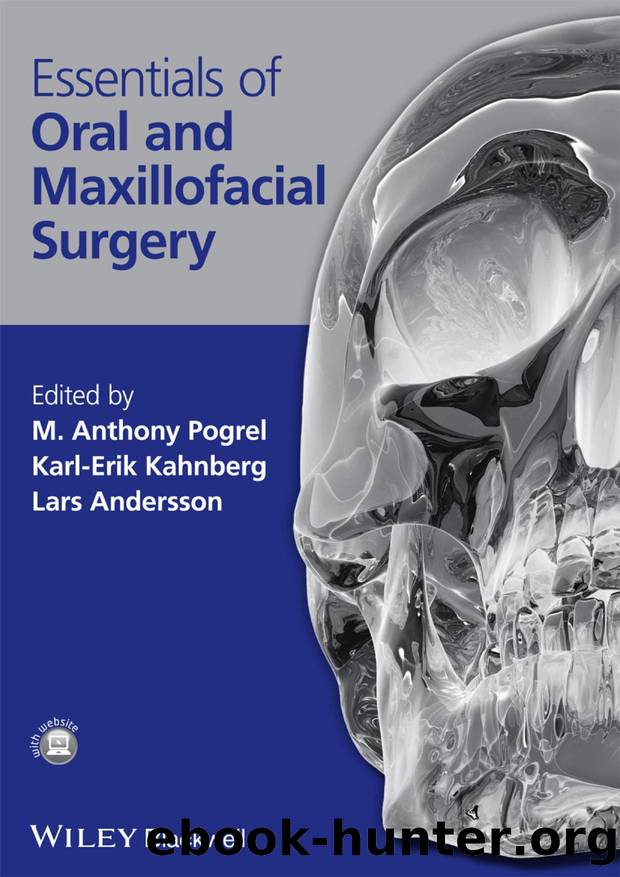 Essentials of Oral and Maxillofacial Surgery by Unknown
