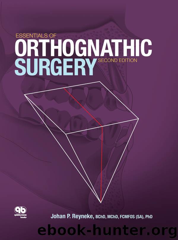 Essentials of Orthognathic Surgery, Second Edition by Johan P. Reyneke