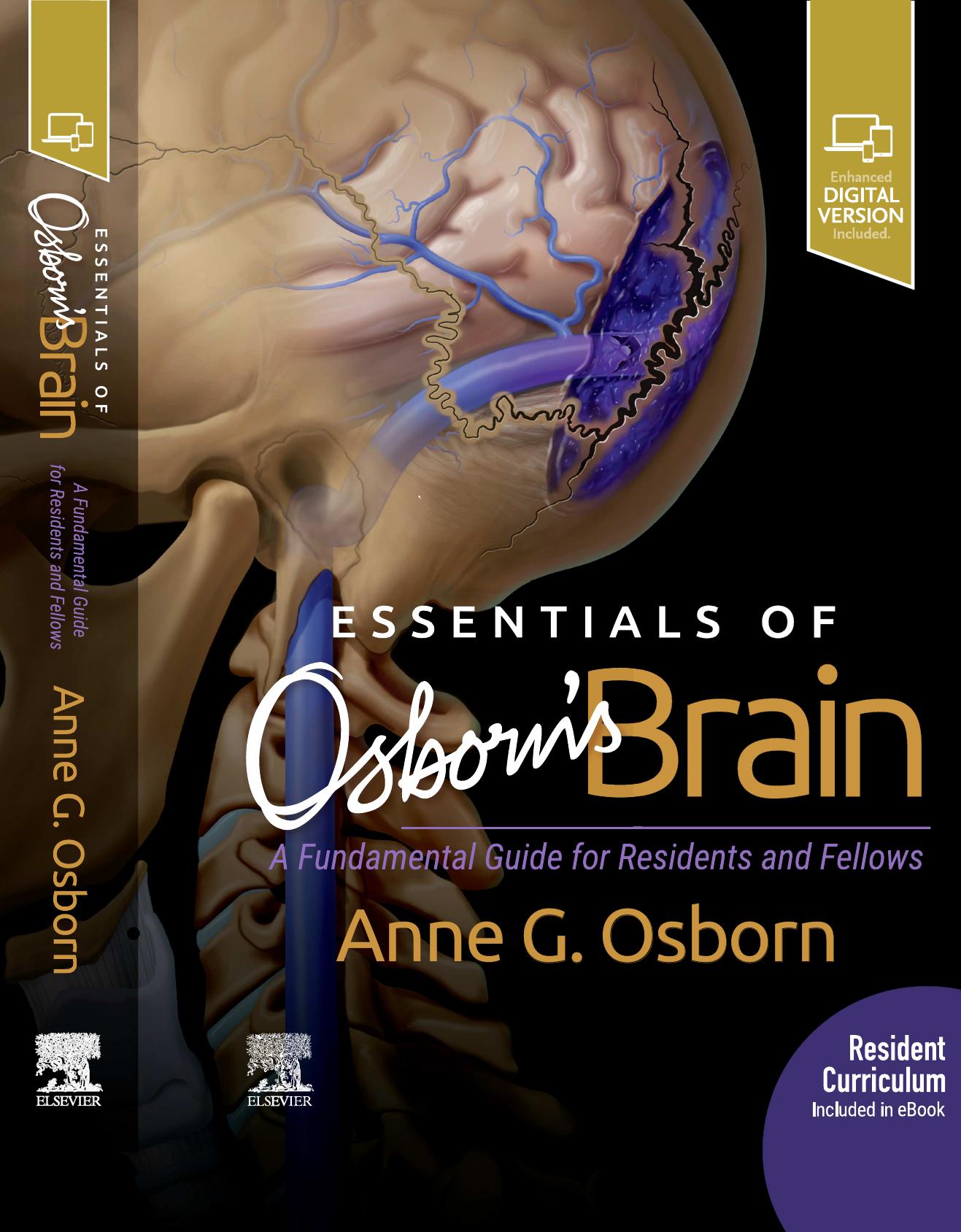 Essentials of Osborn's Brain: A Fundamental Guide for Residents and Fellows, 1e (2020) by Anne G. Osborn MD