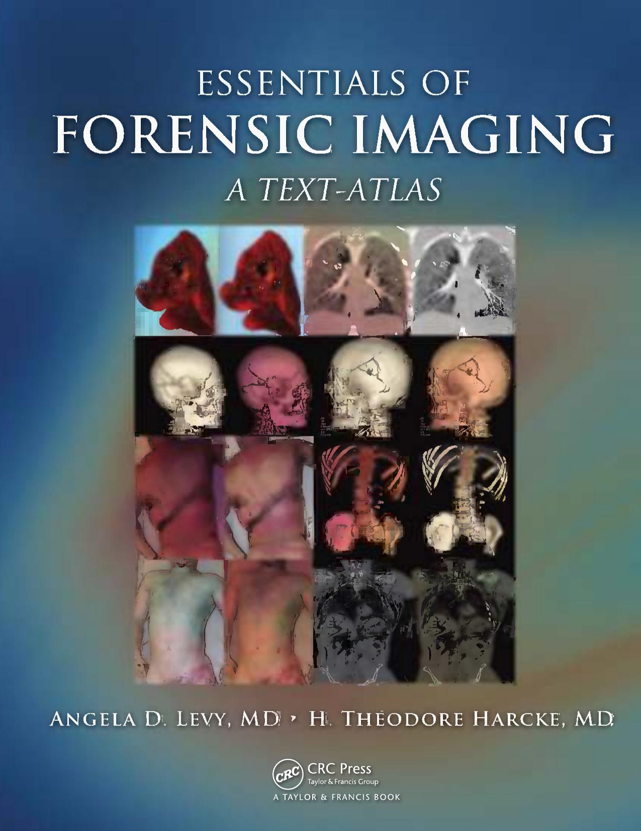 Essentials of forensic imaging : a text-atlas by Angela D Levy; H Theodore Harcke