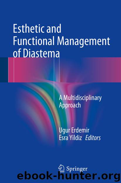 Esthetic and Functional Management of Diastema by Ugur Erdemir & Esra Yildiz
