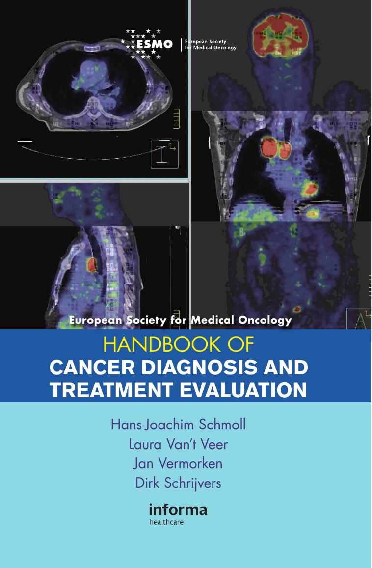 European Society for Medical Oncology Handbook of Cancer Diagnosis and Treatment Evaluation by Schmoll H.-J