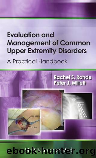 Evaluation and Management of Common Upper Extremity Disorders : A Practical Handbook by Rachel Rohde; Peter Millett